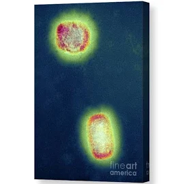 Monkeypox Virus Particles, Tem Canvas Print / Canvas Art by Centre For Infections/public Health England