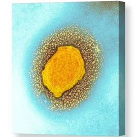 Monkeypox Virus Particle, Tem Canvas Print / Canvas Art by Hazel Appleton, Centre For Infectionshealth Protection Agency