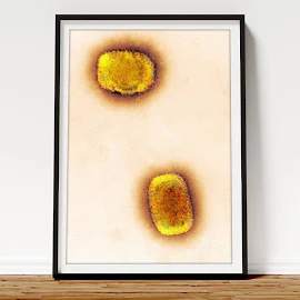 Monkeypox Virus Particles, Tem Framed Print / Framed Art by Centre For Infections/public Health England