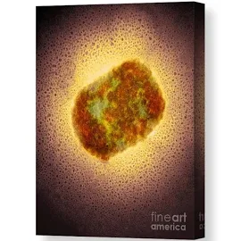 Monkeypox Virus Particle, Tem Canvas Print / Canvas Art by Centre For Infections/public Health England